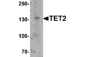 Western blot analysis of TET2 in SK-N-SH cell lysate with TET2 antibody at 1 µg/mL. (TET2 Antikörper  (N-Term))