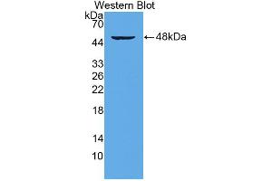Western blot analysis of the recombinant protein. (CD28 Antikörper  (AA 33-174))