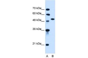 Western Blotting (WB) image for anti-Activin Receptor Type I (ACRV1) (N-Term) antibody (ABIN635876)