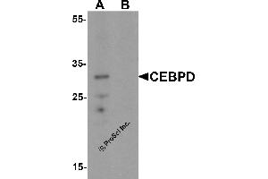 Western Blotting (WB) image for anti-CCAAT/enhancer Binding Protein (C/EBP), delta (CEBPD) (C-Term) antibody (ABIN1077390) (CEBPD Antikörper  (C-Term))