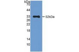 Detection of Recombinant MAPK10, Human using Polyclonal Antibody to Mitogen Activated Protein Kinase 10 (MAPK10) (MAPK10 Antikörper  (AA 88-332))