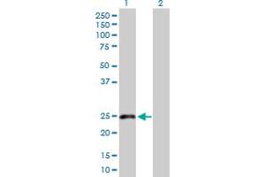 Western Blot analysis of CLEC1B expression in transfected 293T cell line by CLEC1B MaxPab polyclonal antibody. (C-Type Lectin Domain Family 1, Member B (CLEC1B) (AA 1-196) Antikörper)
