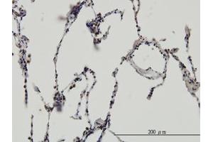 Image no. 3 for anti-Enhancer of Rudimentary Homolog (ERH) (AA 1-105) antibody (ABIN598672) (ERH Antikörper  (AA 1-105))