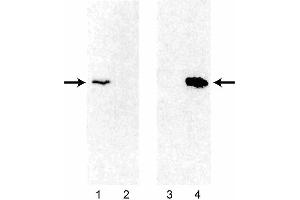 Western blot analysis of Bcl-2 expression using 3F11 and 6C8 monoclonal antibodies in human and mouse thymocytes. (Bcl-2 Antikörper)