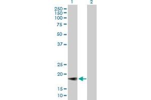 Western Blot analysis of IFNA5 expression in transfected 293T cell line by IFNA5 MaxPab polyclonal antibody. (IFNA5 Antikörper  (AA 1-189))