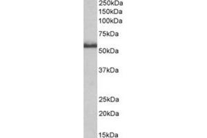 AP31402PU-N CD120b antibody staining of Rat Spinal Cord lysate at 0. (TNFRSF1B Antikörper  (Internal Region))