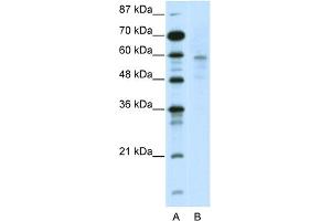 WB Suggested Anti-DMAP1 Antibody Titration:  2. (DMAP1 Antikörper  (N-Term))