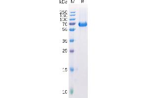 SDS-PAGE (SDS) image for EPH Receptor A2 (EPHA2) (AA 24-534) protein (His tag) (ABIN6964101)
