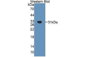 Western blot analysis of the recombinant protein. (AGRN Antikörper  (AA 1329-1548))