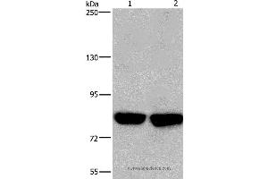 Western blot analysis of Hela and PC3 cell, using PFKP Polyclonal Antibody at dilution of 1:500 (PFKP Antikörper)