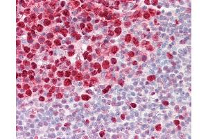 Anti-PCNA / Cyclin antibody IHC of human tonsil.