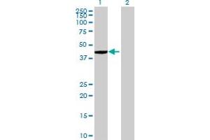 Western Blot analysis of ZNF707 expression in transfected 293T cell line by ZNF707 MaxPab polyclonal antibody. (ZNF707 Antikörper  (AA 1-369))
