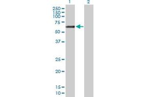 Western Blot analysis of GALNT14 expression in transfected 293T cell line by GALNT14 MaxPab polyclonal antibody.