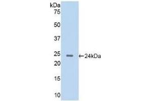 Detection of Recombinant CTSG, Rat using Polyclonal Antibody to Cathepsin G (CTSG) (Cathepsin G Antikörper  (AA 51-250))