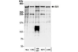 Western Blotting (WB) image for anti-RAP1 Interacting Factor Homolog (RIF1) (AA 1425-1450) antibody (ABIN7454645) (RIF1 Antikörper  (AA 1425-1450))