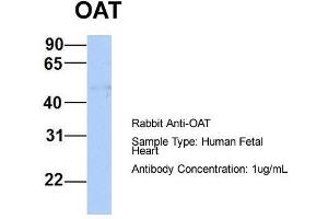 Host:  Rabbit  Target Name:  OAT  Sample Type:  Human Fetal Heart  Antibody Dilution:  1. (OAT Antikörper  (Middle Region))