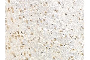 ABIN7094789 and ABIN7098840 at 1/100 staining Rat brain tissue by IHC-P.