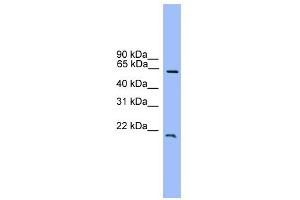 WB Suggested Anti-DACH1 Antibody Titration:  0. (DACH1 Antikörper  (C-Term))
