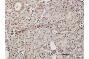 Immunoperoxidase of monoclonal antibody to HIPK1 on formalin-fixed paraffin-embedded human salivary gland. (HIPK1 Antikörper  (AA 330-430))