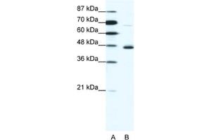 Western Blotting (WB) image for anti-Neuronal Differentiation 1 (NEUROD1) antibody (ABIN2460360) (NEUROD1 Antikörper)