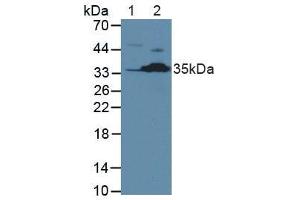 Western blot analysis of (1) Human Jurkat Cells and (2) Mouse Kidney Tissue. (Caspase 2 Antikörper  (AA 334-452))