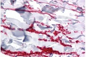 Human Skin, Dermis: Formalin-Fixed, Paraffin-Embedded (FFPE) (FAM59A Antikörper  (C-Term))