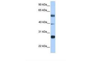 Image no. 1 for anti-MAX Dimerization Protein 3 (MXD3) (N-Term) antibody (ABIN6737887) (MXD3 Antikörper  (N-Term))