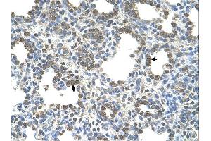 Immunohistochemistry (IHC) image for anti-Solute Carrier Family 26, Member 5 (Prestin) (SLC26A5) (Middle Region) antibody (ABIN2781751) (SLC26A5 Antikörper  (Middle Region))