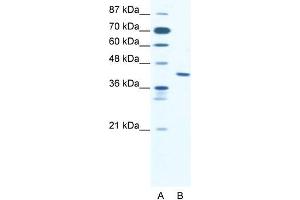 Human Jurkat; WB Suggested Anti-ZNF621 Antibody Titration: 2. (ZNF621 Antikörper  (Middle Region))