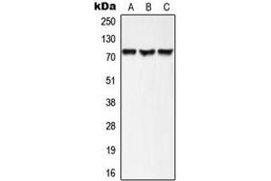 Western blot analysis of AKAP10 expression in HepG2 (A), mouse heart (B), rat heart (C) whole cell lysates. (AKAP10 Antikörper  (N-Term))