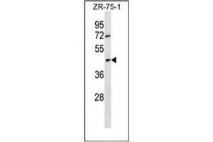 Western blot analysis of OR2T6 Antibody (C-term) in ZR-75-1 cell line lysates (35ug/lane). (OR2T6 Antikörper  (C-Term))