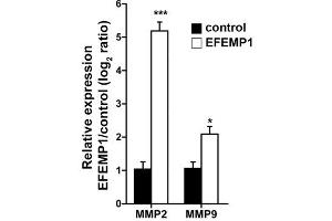 Activity Assay (AcA) image for Fibulin 3 (FBLN3) (Transcript Variant 1) (Active) protein (Myc-DYKDDDDK Tag) (ABIN2719970)