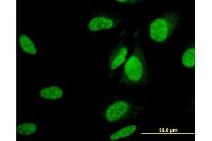 Immunofluorescence (IF) image for anti-Ubiquitin-Like Modifier Activating Enzyme 6 (UBA6) (AA 962-1051) antibody (ABIN527447)