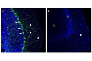 Expression of Netrin-1 in mouse cerebellum.