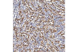 IHC analysis of TP53I13 using anti-TP53I13 antibody (ABIN7601220). (TP53I13 Antikörper  (AA 30-365))