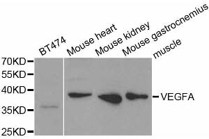 Western blot analysis of extracts of various cell lines, using VEGFA antibody (ABIN5973338) at 1/1000 dilution. (VEGFA Antikörper)