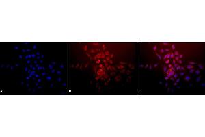 Immunocytochemistry/Immunofluorescence analysis using Rabbit Anti-SOD (Mn) Polyclonal Antibody (ABIN361655 and ABIN361656). (SOD2 Antikörper)