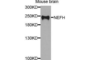 Western blot analysis of extracts of mouse brain, using NEFH antibody (ABIN5974903) at 1/1000 dilution. (NEFH Antikörper)