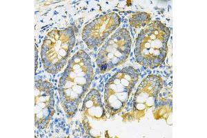 Immunohistochemistry of paraffin-embedded rat intestine using HSP90AB1 Antibody. (HSP90AB1 Antikörper  (AA 1-300))