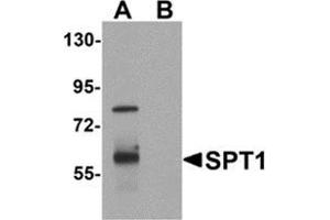 Western blot analysis of VASH1 in human brain tissue lysate with VASH1 antibody at 1 μg/ml in (A) the absence and (B) the presence of blocking peptide. (VASH1 Antikörper  (C-Term))