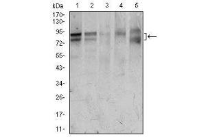 Image no. 4 for anti-Forkhead Box P1 (FOXP1) antibody (ABIN1491561) (FOXP1 Antikörper)