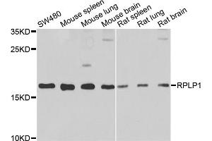 Western blot analysis of extracts of various cell lines, using RPLP1 antibody (ABIN2559767) at 1:1000 dilution. (RPLP1 Antikörper)