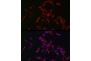 Immunofluorescence analysis of PC-12 cells using MR1 Rabbit pAb (ABIN6131925, ABIN6143983, ABIN6143984 and ABIN6224070) at dilution of 1:100 (40x lens). (MR1 Antikörper  (AA 20-260))