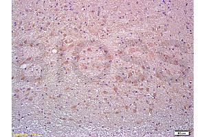 Formalin-fixed and paraffin embedded rat brain tissue labeled with Anti-Thy-1/CD90/ Thy1. (CD90 Antikörper  (AA 31-120))