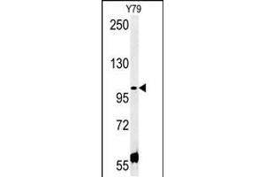 Western blot analysis in Y79 cell line lysates (35ug/lane). (CCDC146 Antikörper  (N-Term))