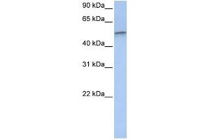Vimentin antibody used at 1 ug/ml to detect target protein. (Vimentin Antikörper  (C-Term))