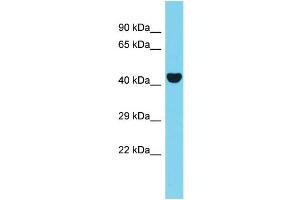 Host: Rabbit Target Name: AAR2 Sample Type: 721_B Whole Cell lysates Antibody Dilution: 1. (C20orf4 Antikörper  (N-Term))