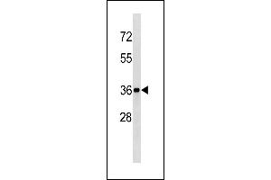 BLVRA Antibody (Center Y83) (ABIN1881115 and ABIN2843340) western blot analysis in mouse kidney tissue lysates (35 μg/lane). (Biliverdin Reductase Antikörper  (AA 61-89))