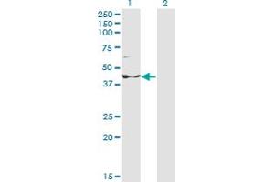 Western Blot analysis of INPP1 expression in transfected 293T cell line by INPP1 monoclonal antibody (M14), clone 1A6. (INPP1 Antikörper  (AA 1-399))