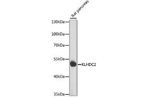 Western blot analysis of extracts of Rat pancreas using KLHDC2 Polyclonal Antibody at dilution of 1:1000. (KLHDC2 Antikörper)